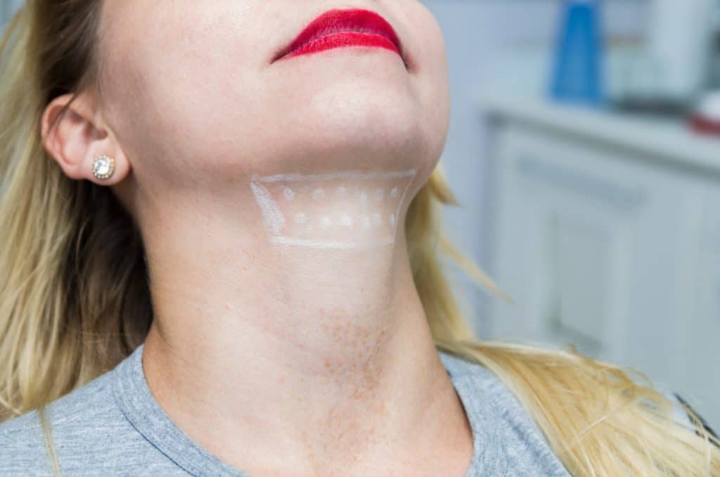 Kybella Services | FineTune Medspa in Worth, TX