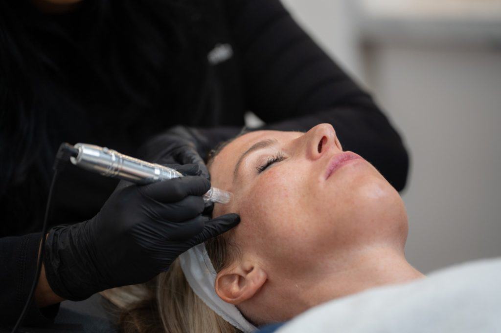 Microneedling Services | FineTune Medspa in Worth, TX