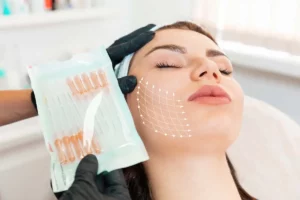 Thread lifts by Finetune MedSpa in Frisco TX