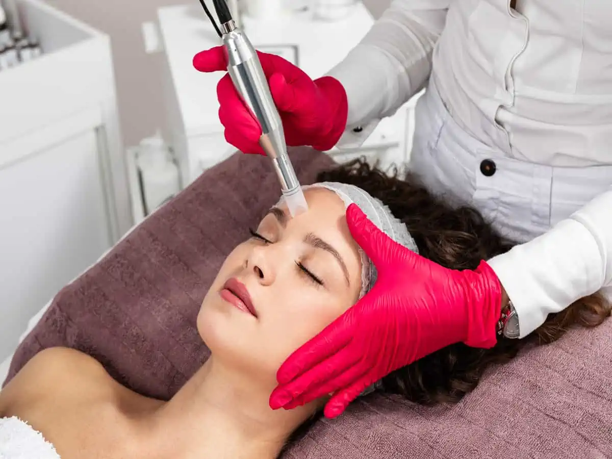 Microneedling by finetunemedspa in texas