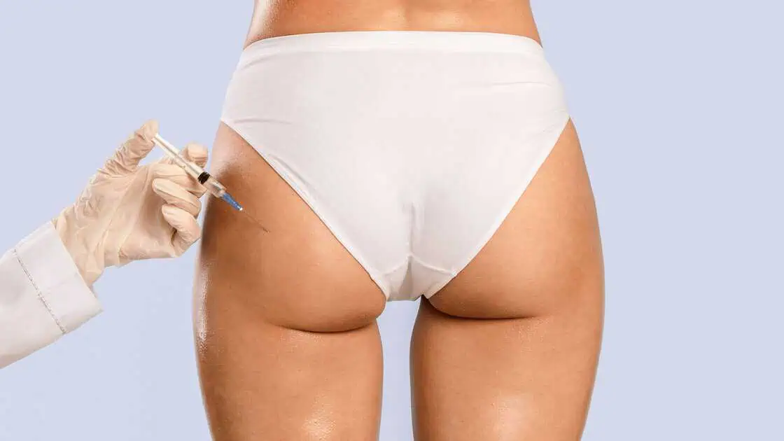 Sculptra Butt Lift in Frisco TX by Altwood Little Elm Frisco FINETUNE Medspa